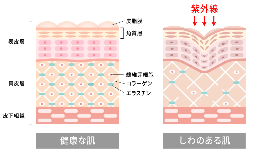 見た目の低下を保湿で回避
