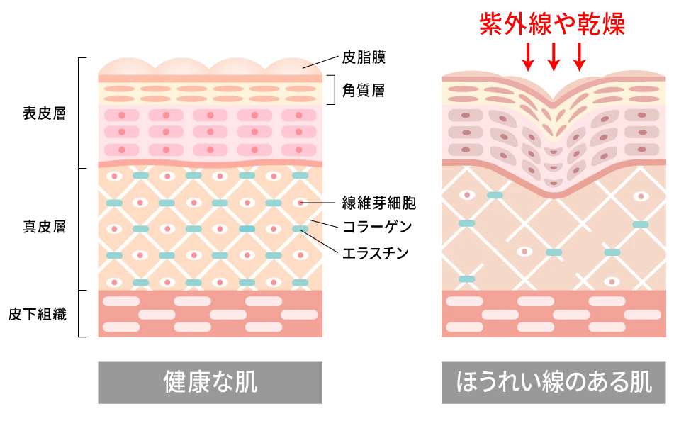 年齢が出やすい口元を保湿